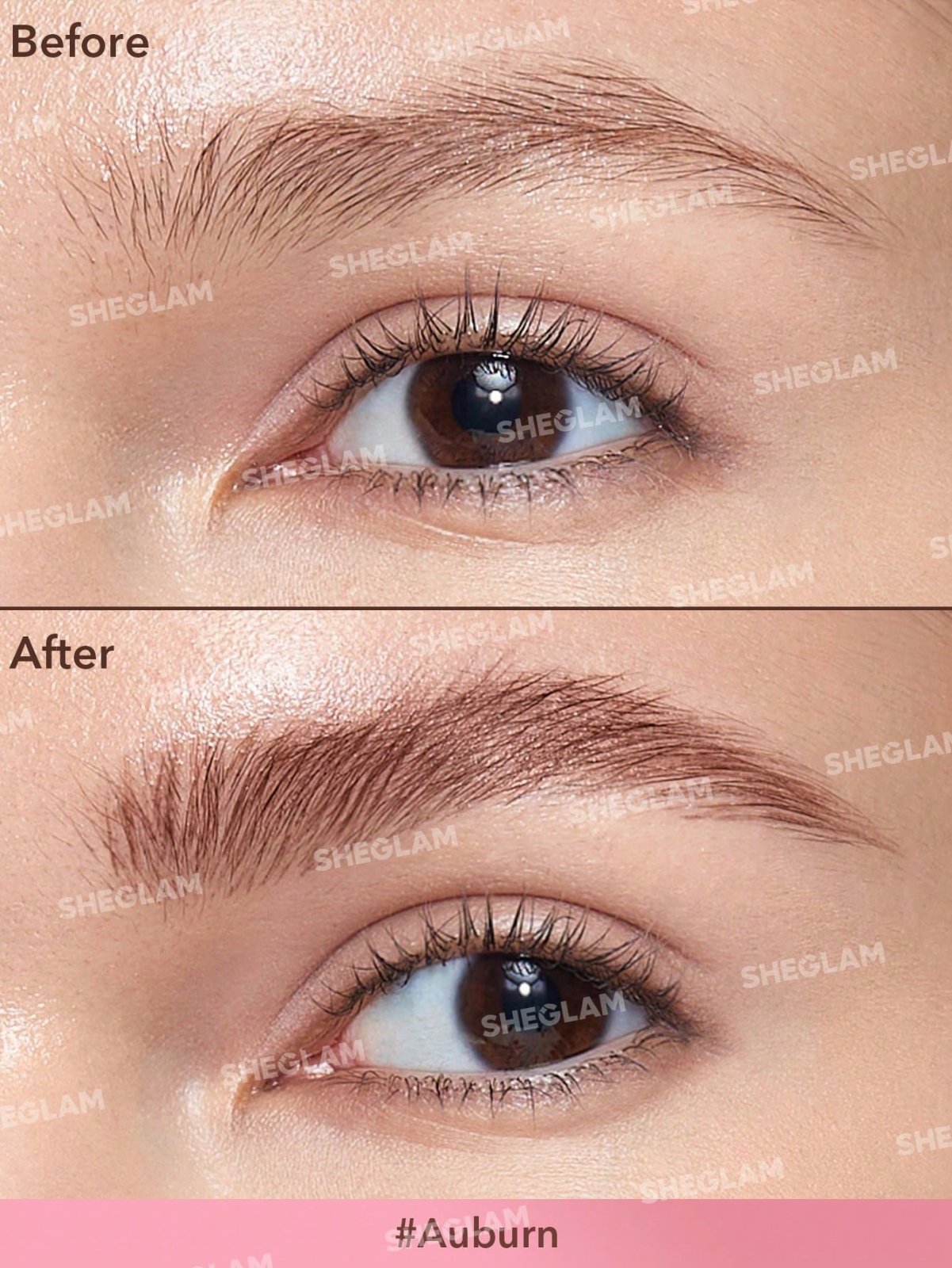 Brow fection 