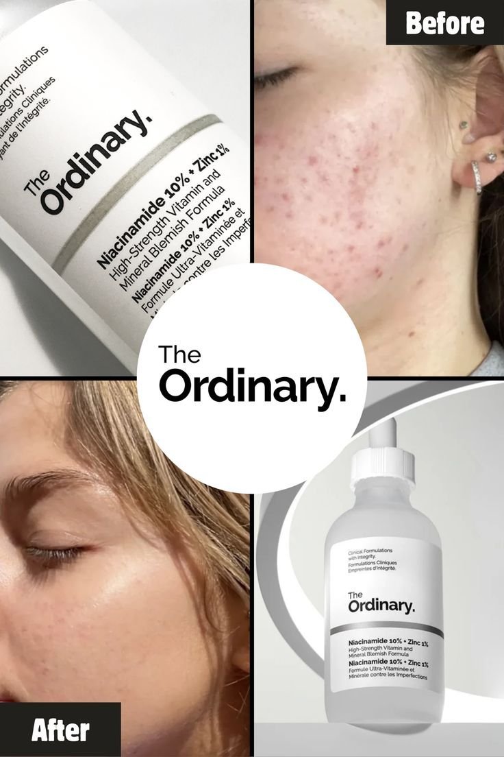 The ordinary Niacinamide 