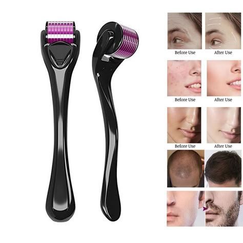 Derma roller 😍 
